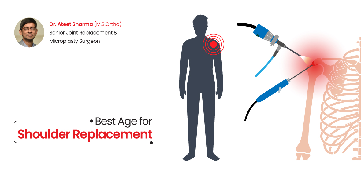 age for shoulder replacement
