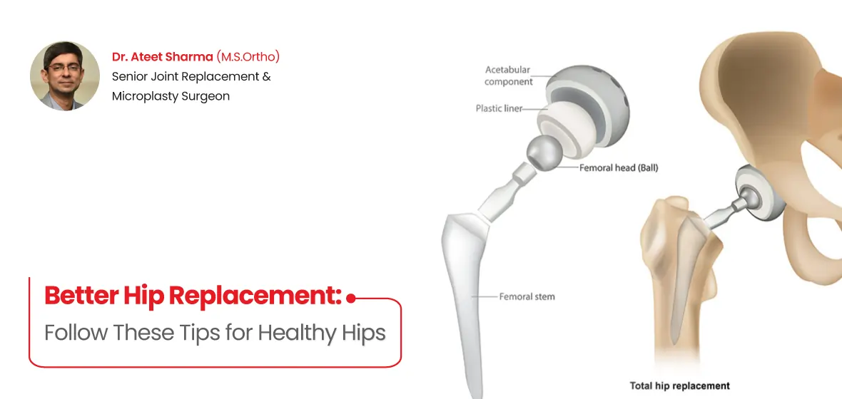 hip replacement