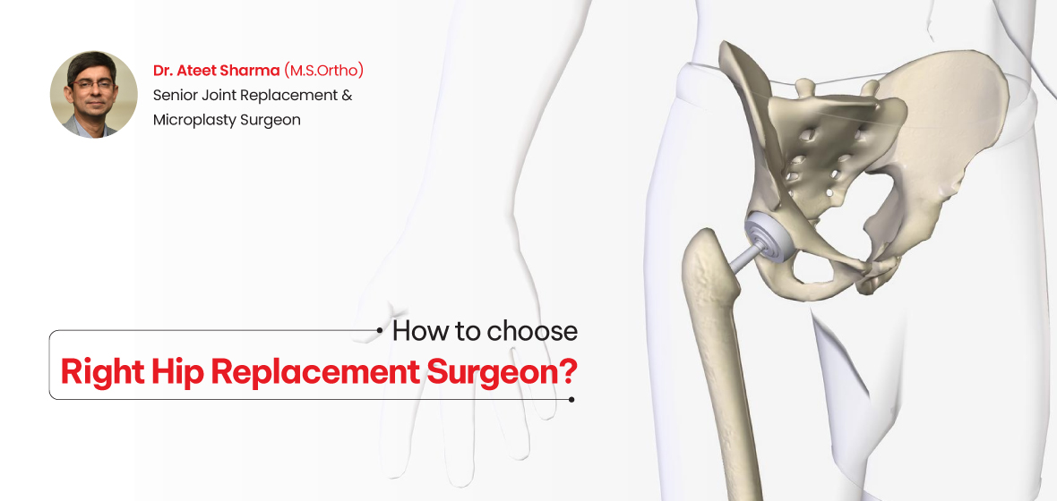 choose the right hip replacement surgeon