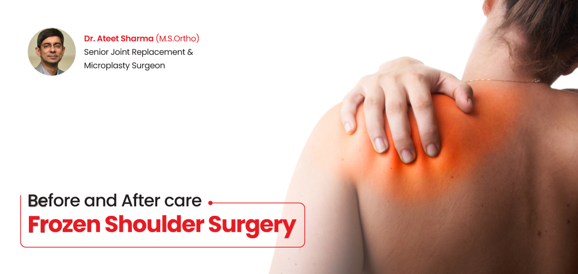 frozen shoulder surgery