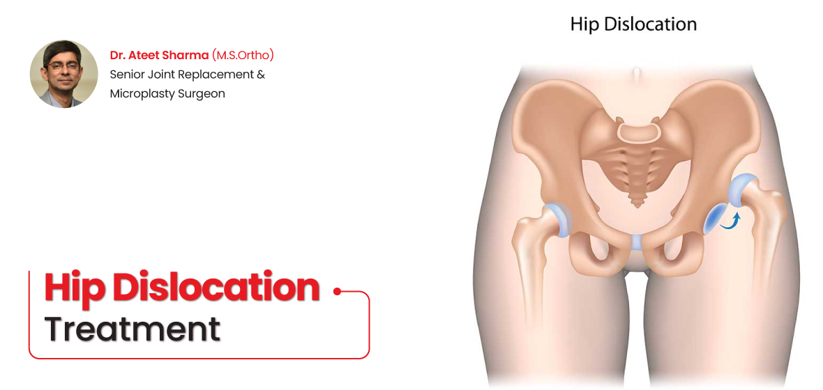 hip dislocation treatment
