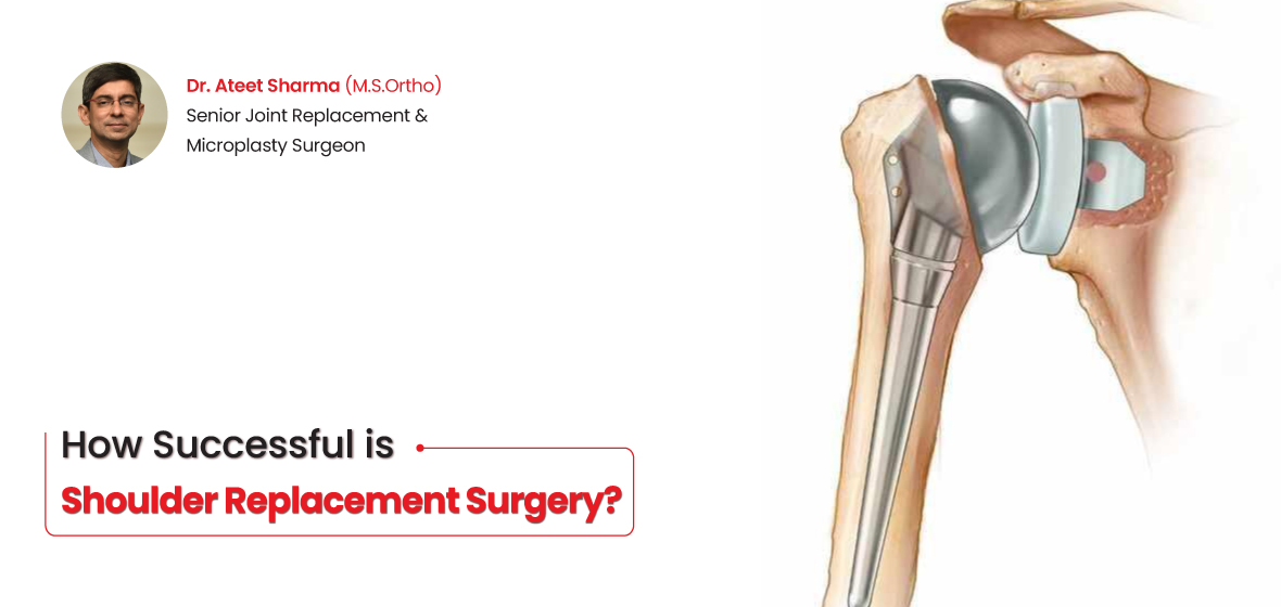 How successful is shoulder replacement?