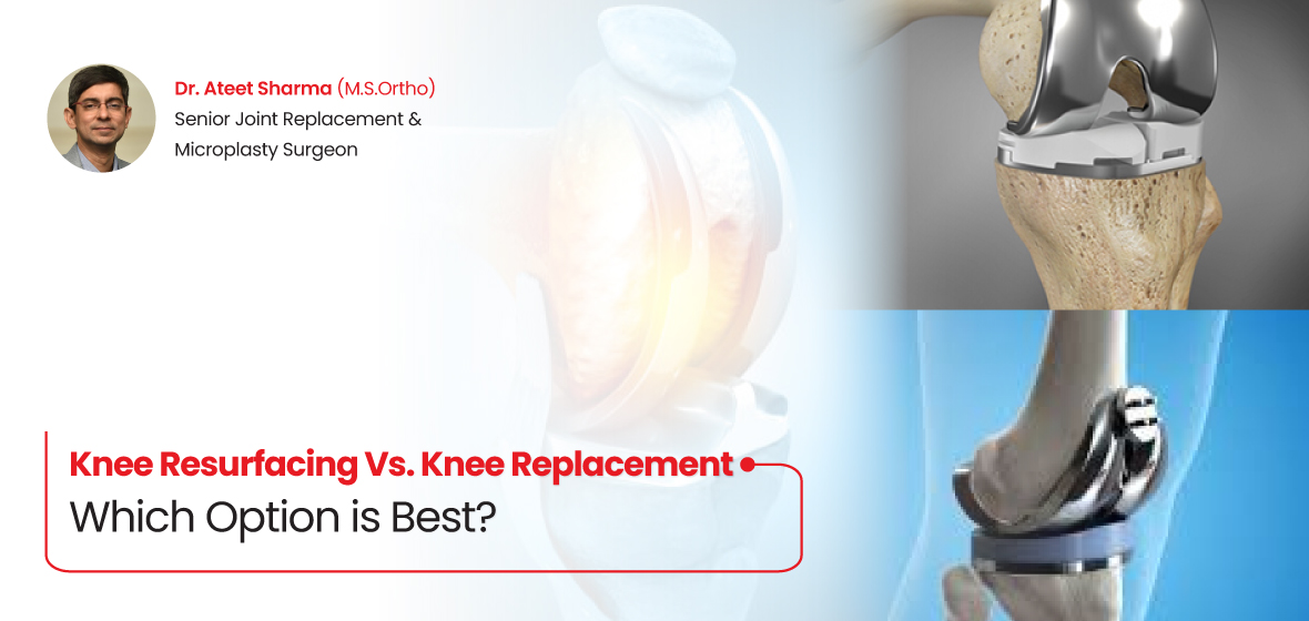 knee resurfacing vs knee replacement