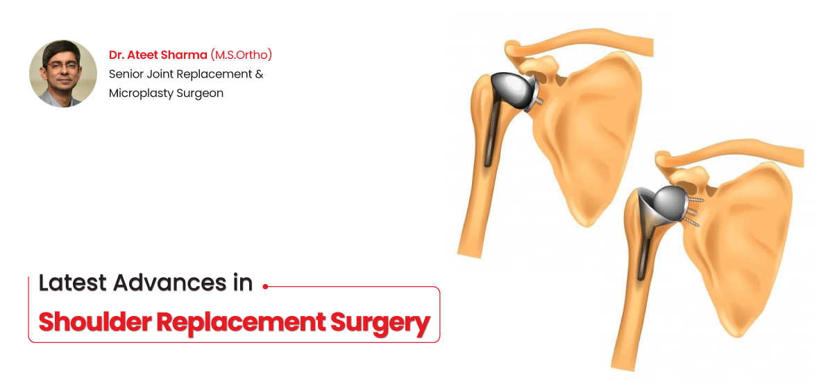 latest advances in shoulder replacement