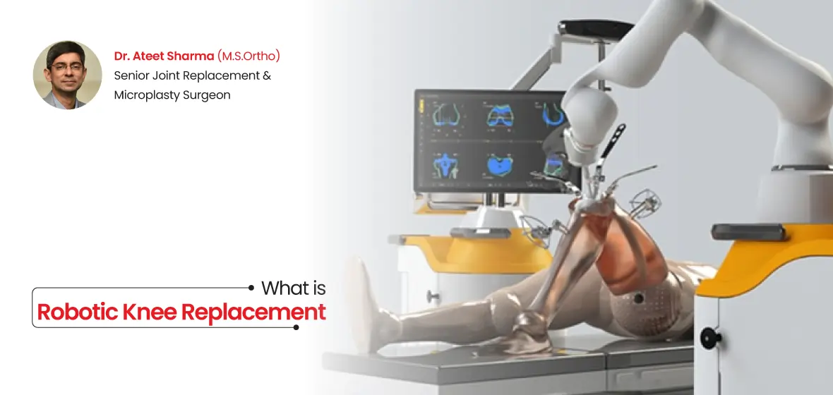 Robotic Knee Replacement