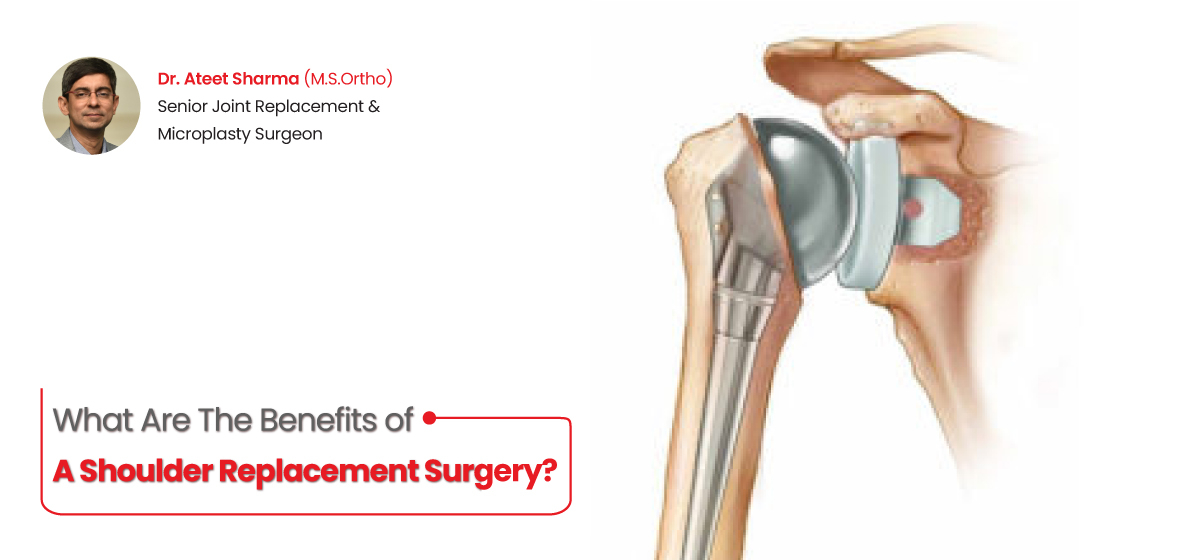 Benefits of a Shoulder Replacement Surgery