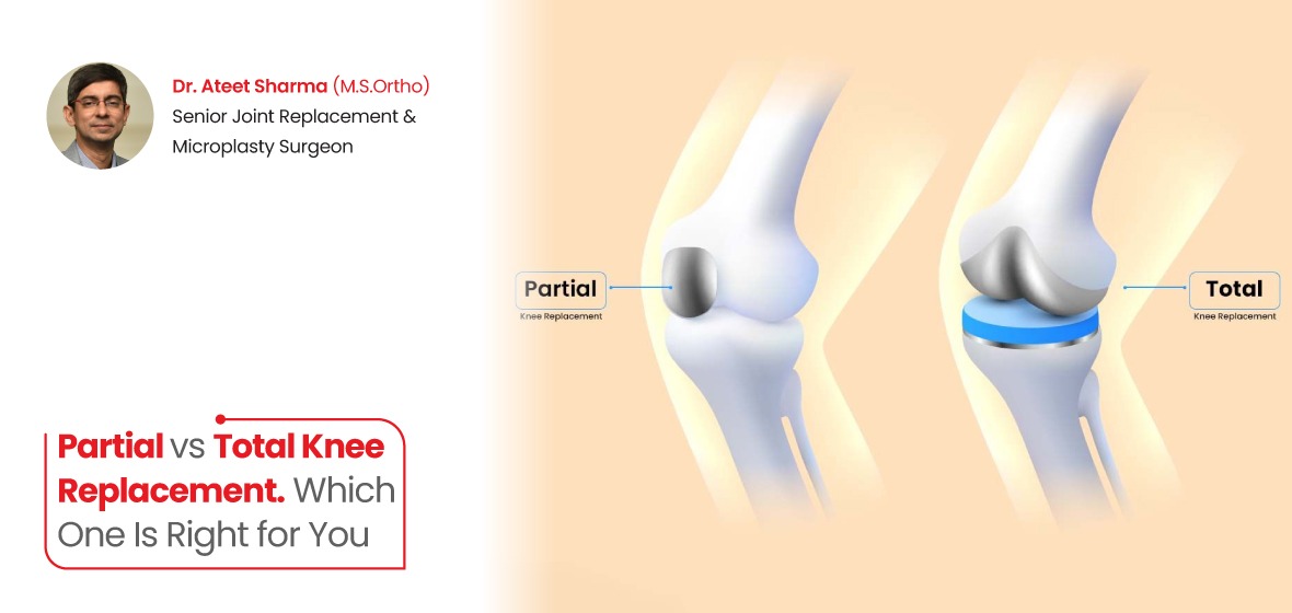 Knee Replacement in Ahmedabad