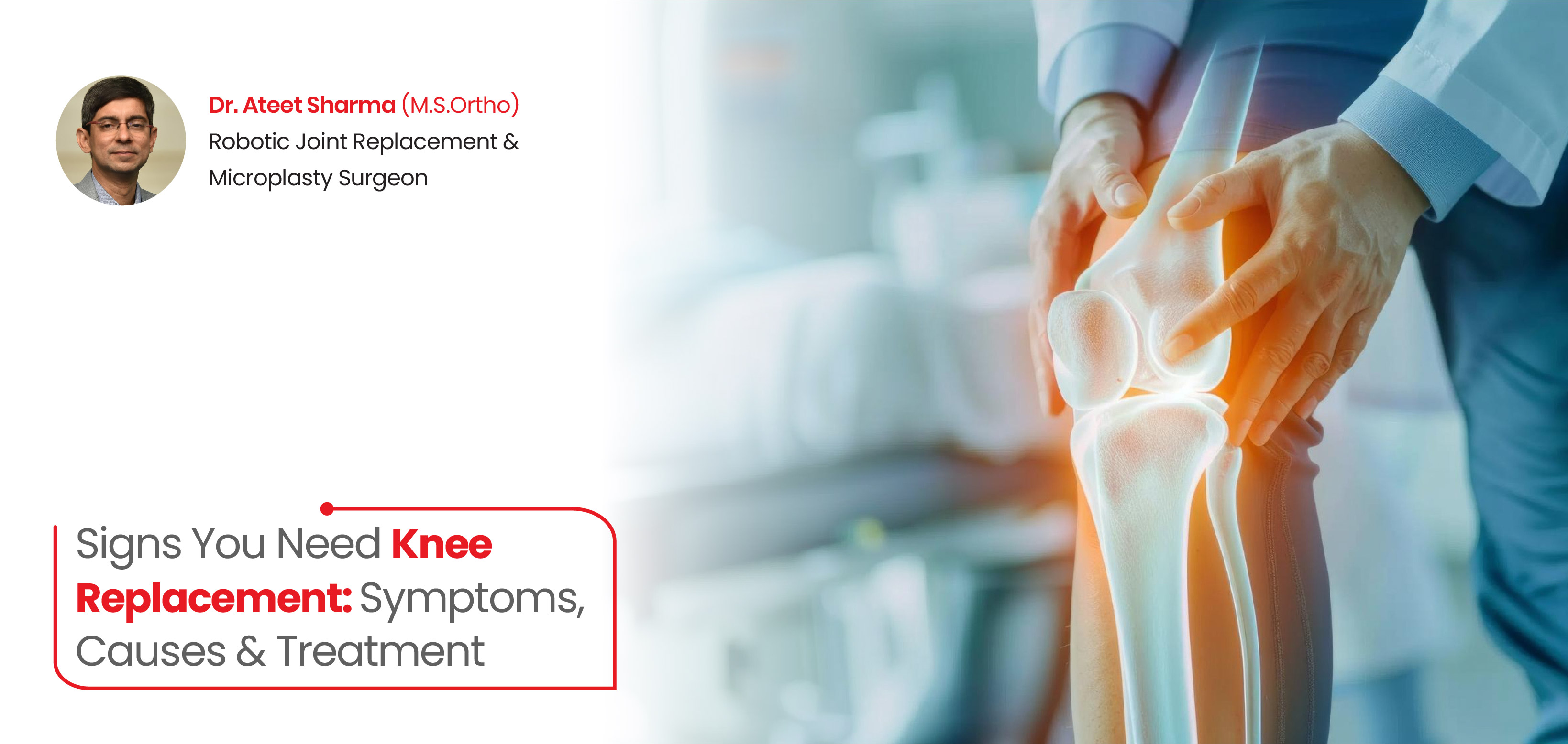 Signs You Need Knee Replacement: Symptoms, Causes & Treatment